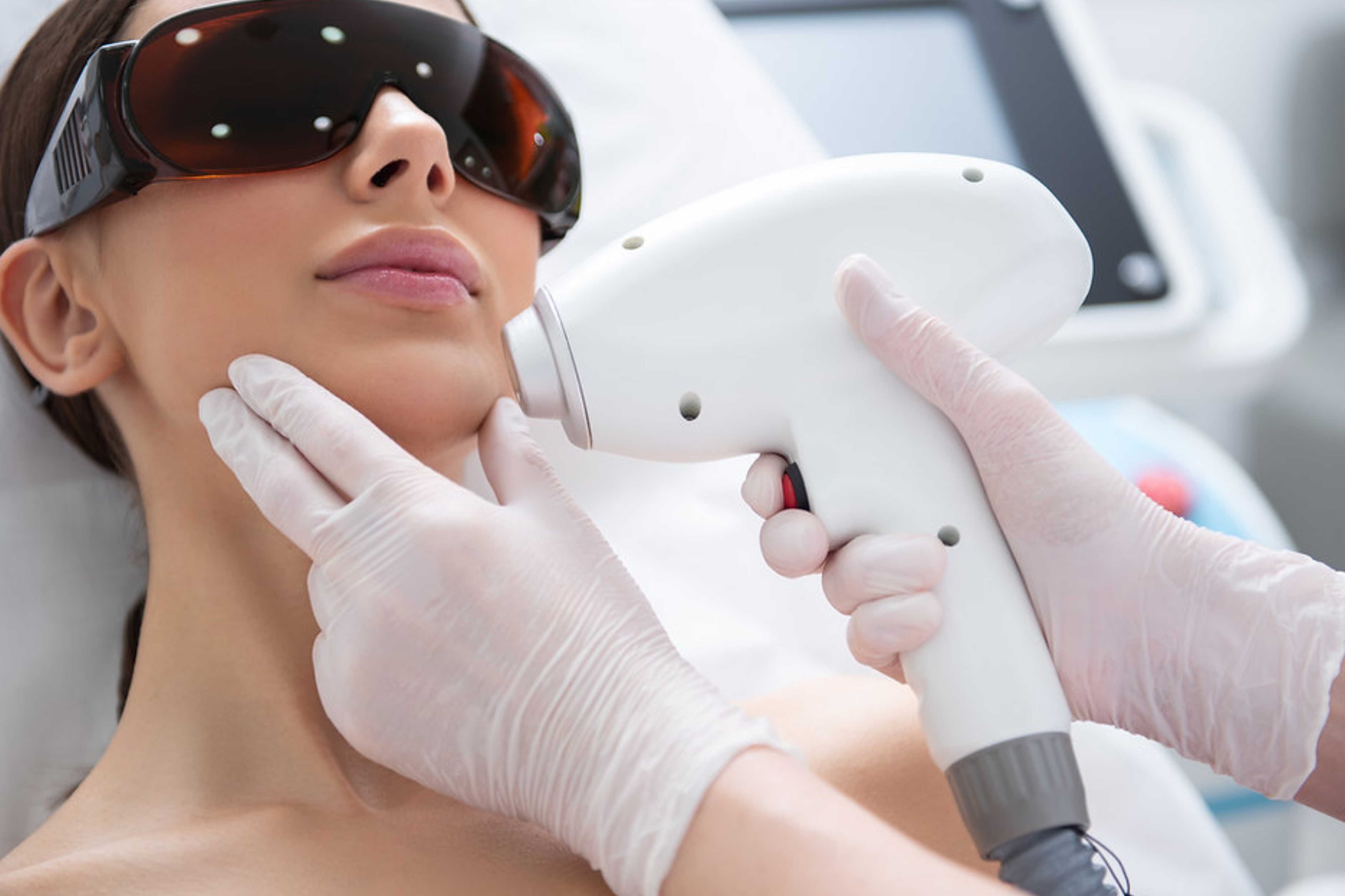 Professional laser hair removal equipment